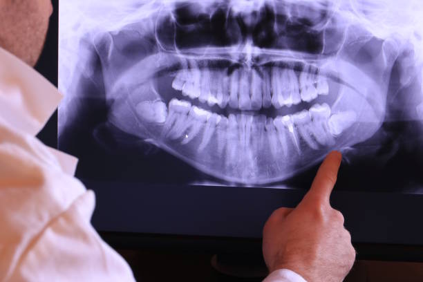 Best Emergency Tooth Extraction in Crystal Springs, MS