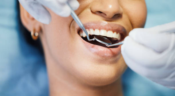 Best Emergency Root Canal Treatment in Crystal Springs, MS