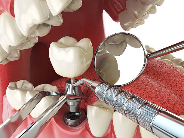 Best Emergency Treatment for Toothache in Crystal Springs, MS